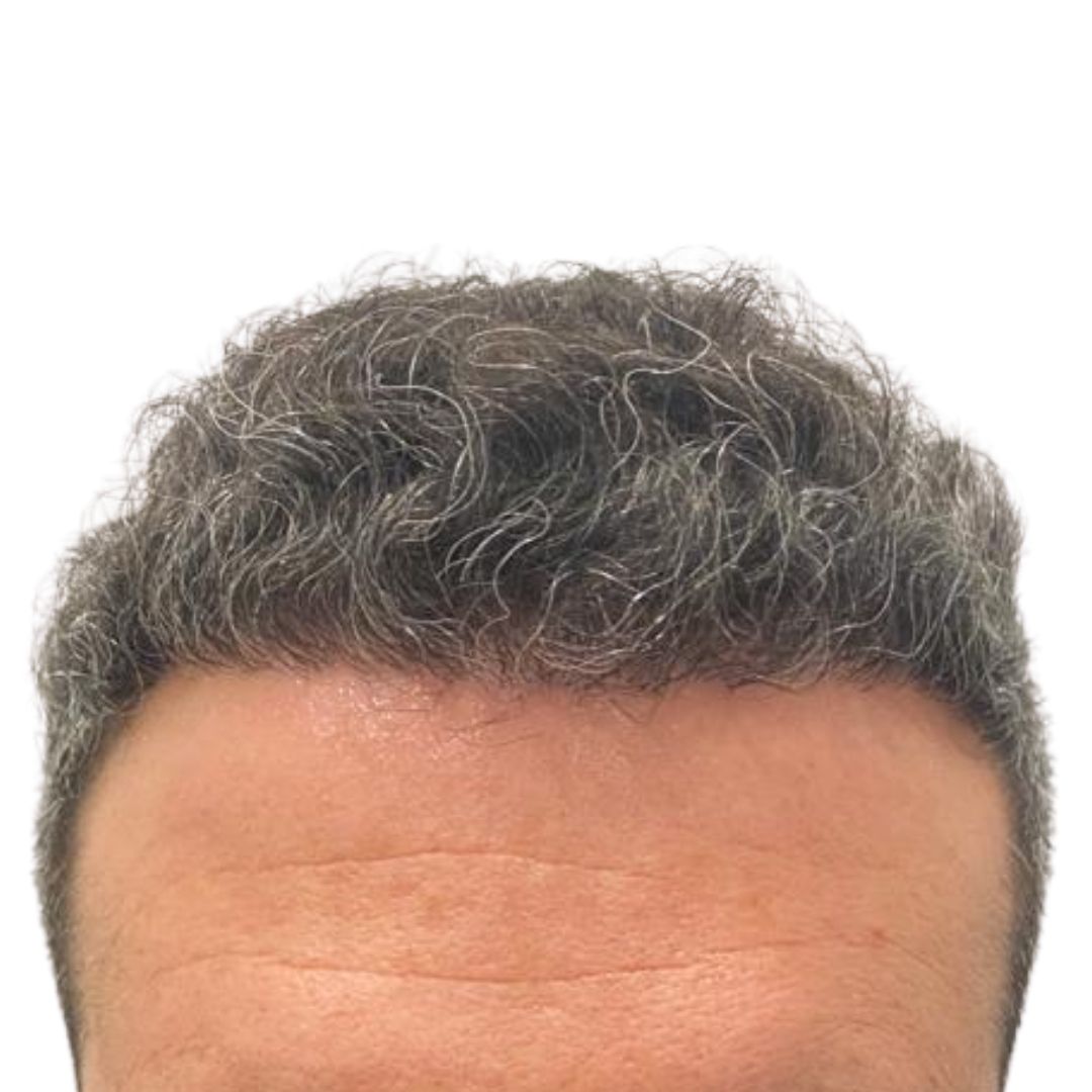 19.1