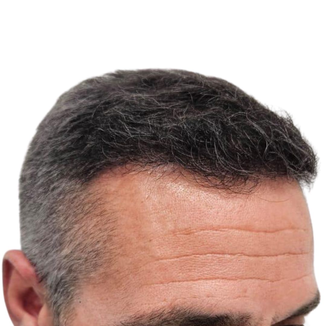 9.1